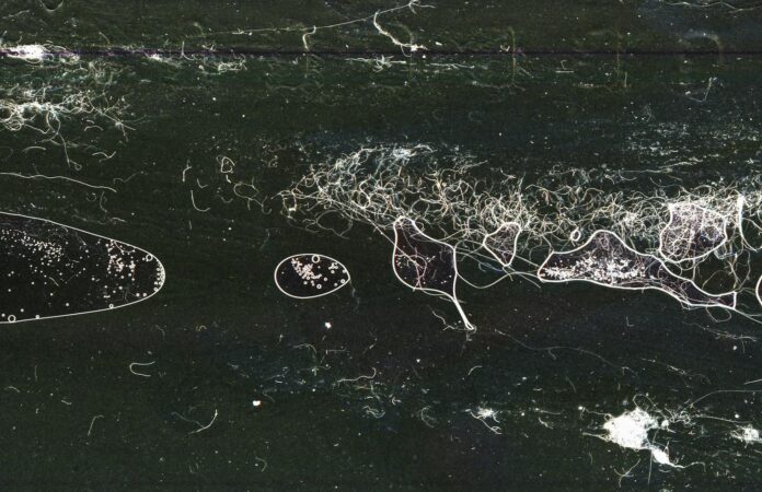 close-up-photography-negative